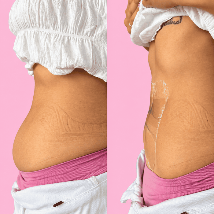 Cintas lifting para el abdomen (10 cintas)