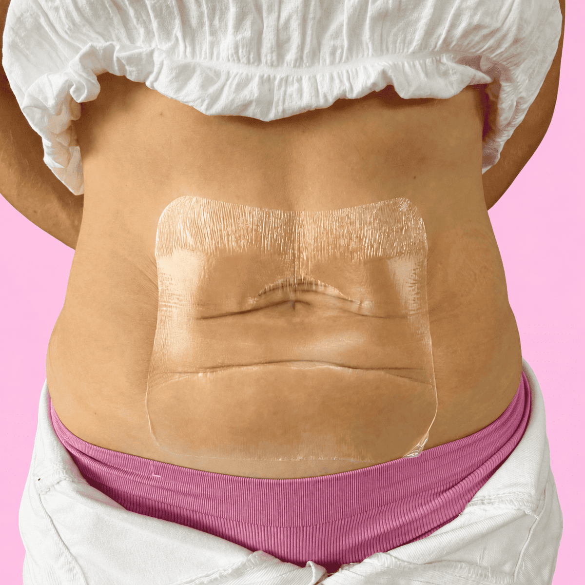 Cintas lifting para el abdomen (10 cintas)