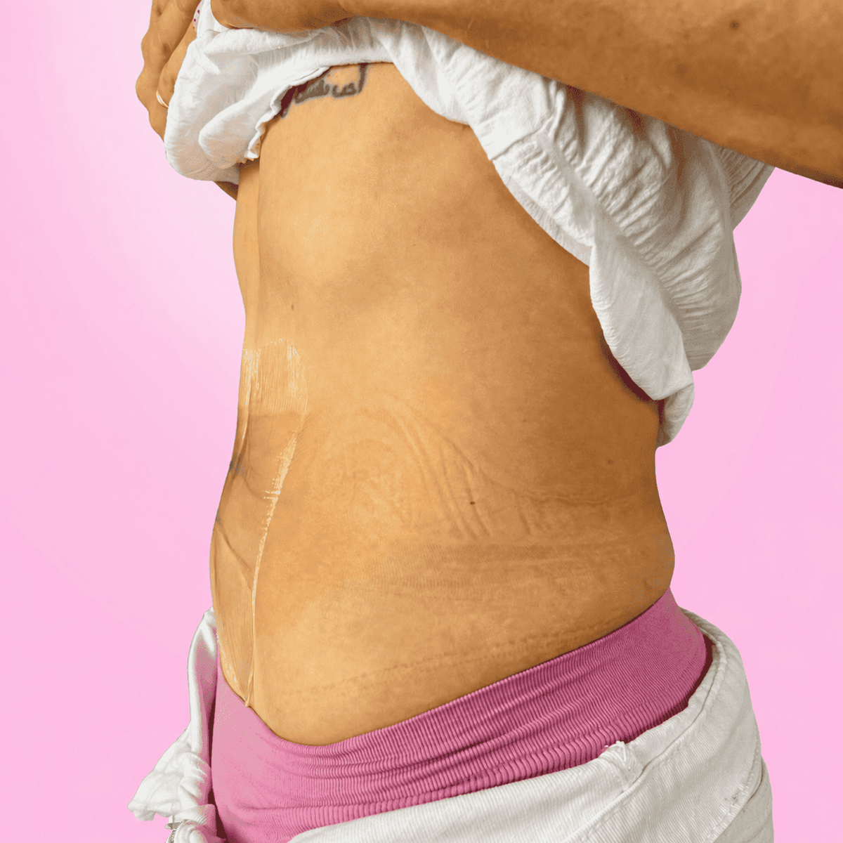 Cintas lifting para el abdomen (10 cintas)